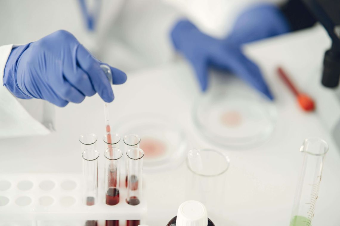 Scientist working with test tube and petri dish